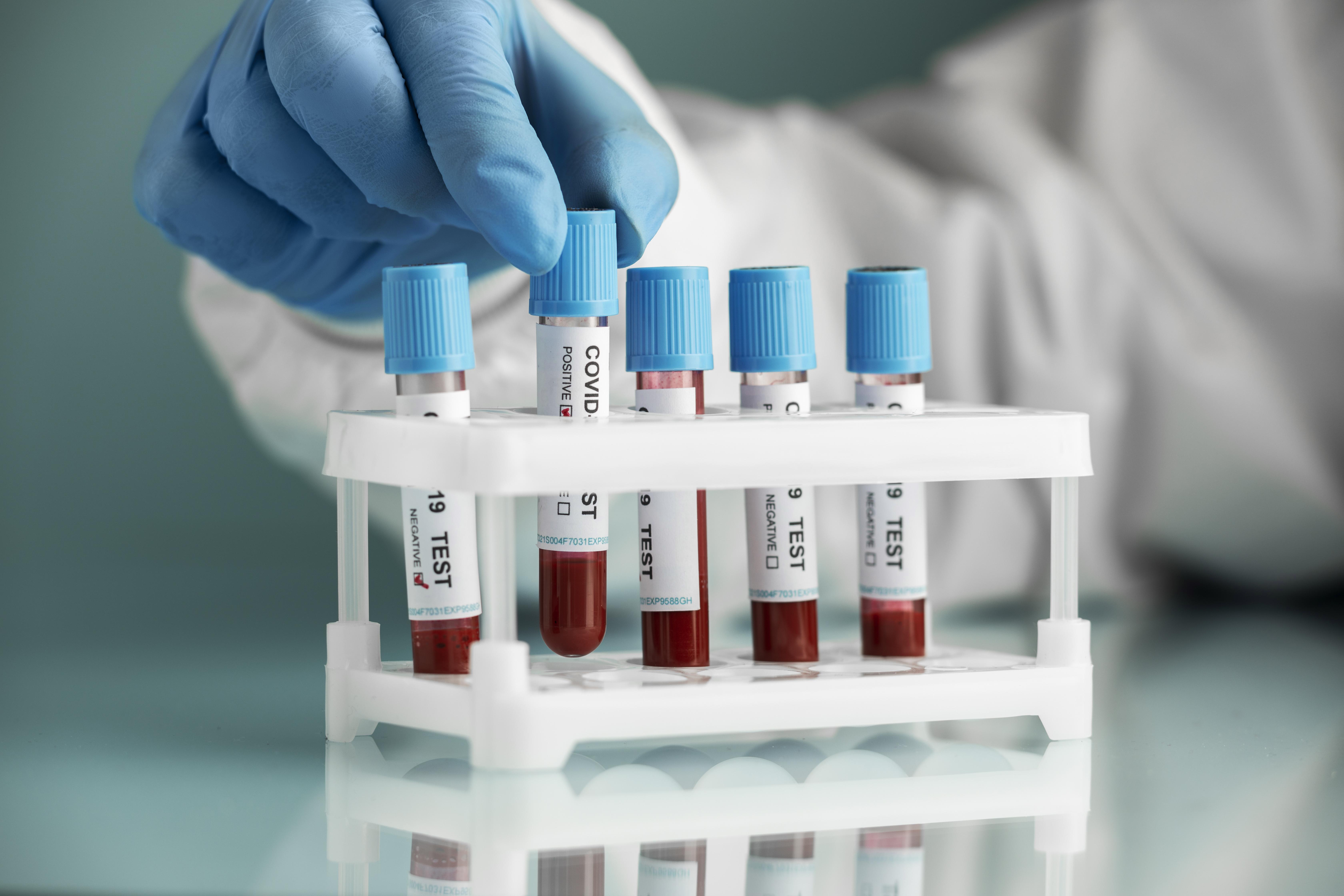 Bioanalytical Lab